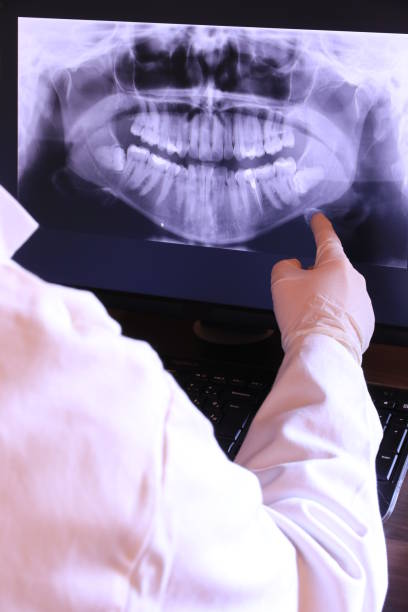 Best Emergency Denture Repair in Shorewood Tower Hills Harbert, MI